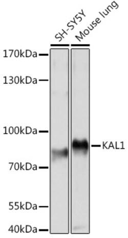 ABclonal Technology&nbsp;KAL1 Rabbit pAb