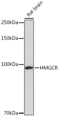 ABclonal Technology&nbsp;HMGCR Rabbit pAb