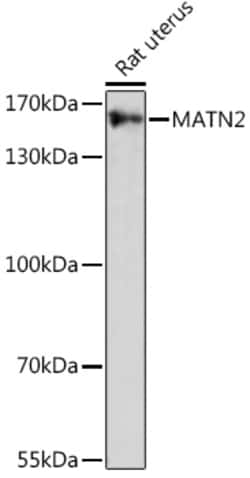ABclonal Technology&nbsp;MATN2 Rabbit pAb