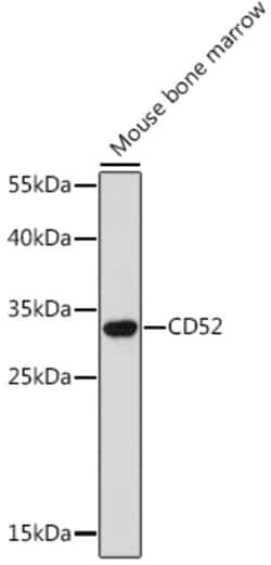 ABclonal Technology&nbsp;CD52 Rabbit pAb