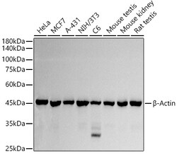 ABclonal Technology&nbsp;β-Actin Rabbit pAb