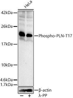 ABclonal Technology&nbsp;Phospho-PLN-T17 Rabbit pAb