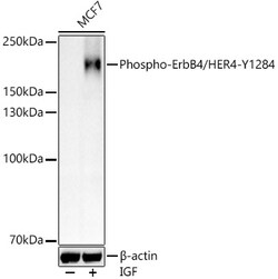 ABclonal Technology&nbsp;Phospho-ErbB4/HER4-Y1284 Rabbit pAb