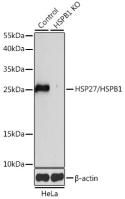 ABclonal Technology&nbsp;[KO Validated] HSP27/HSPB1 Rabbit pAb