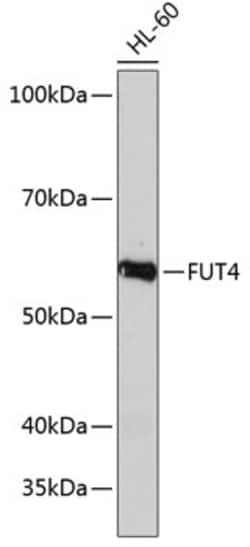 ABclonal Technology&nbsp;FUT4 Rabbit pAb