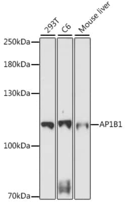 ABclonal Technology&nbsp;AP1B1 Rabbit pAb