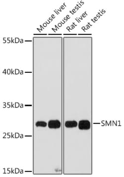 ABclonal Technology&nbsp;SMN1 Rabbit pAb