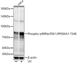 ABclonal Technology&nbsp;Phospho-p90Rsk/RSK1/RPS6KA1-T348 Rabbit pAb