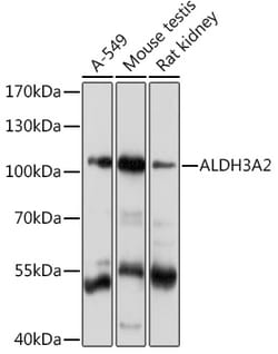 ABclonal Technology&nbsp;ALDH3A2 Rabbit pAb