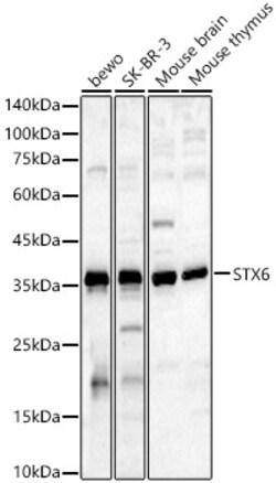 ABclonal Technology&nbsp;STX6 Rabbit pAb