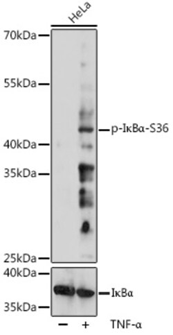 ABclonal Technology&nbsp;Phospho-IκBα-S36 Rabbit pAb