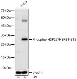 ABclonal Technology&nbsp;Phospho-HSP27/HSPB1-S15 Rabbit pAb