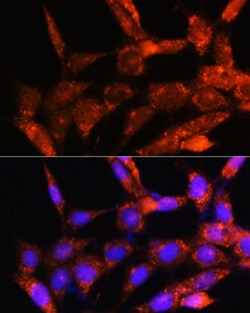 ABclonal Technology&nbsp;COX6C Rabbit pAb