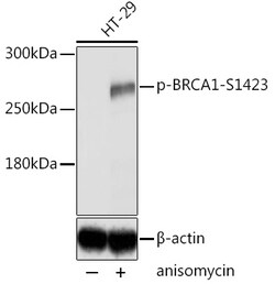 ABclonal Technology&nbsp;Phospho-BRCA1-S1423 Rabbit pAb