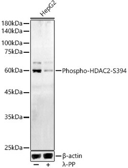 ABclonal Technology&nbsp;Phospho-HDAC2-S394 Rabbit pAb