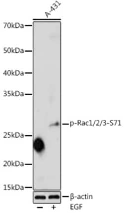 ABclonal Technology&nbsp;Phospho-Rac1/2/3-S71 Rabbit pAb