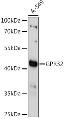 ABclonal Technology&nbsp;GPR32 Rabbit pAb