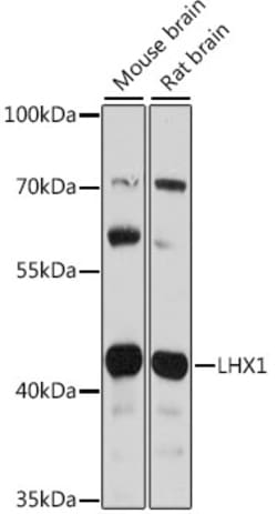 ABclonal Technology&nbsp;LHX1 Rabbit pAb