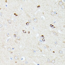 ABclonal Technology&nbsp;CCDC6 Rabbit pAb
