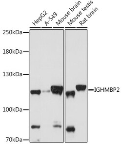 ABclonal Technology&nbsp;IGHMBP2 Rabbit pAb