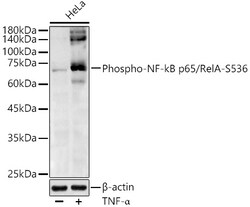ABclonal Technology&nbsp;Phospho-NF-kB p65/RelA-S536 Rabbit pAb