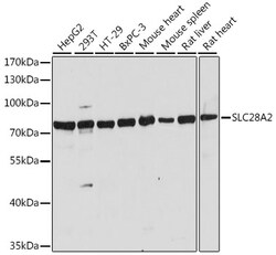 ABclonal Technology&nbsp;SLC28A2 Rabbit pAb