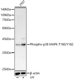 ABclonal Technology&nbsp;Phospho-p38 MAPK-T180/Y182 Rabbit pAb