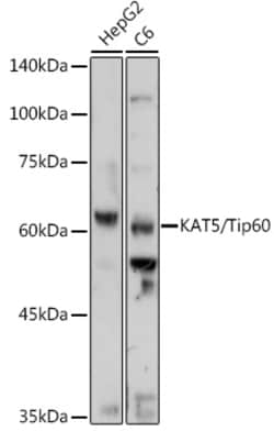 ABclonal Technology&nbsp;KAT5/Tip60 Rabbit pAb