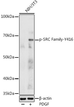 ABclonal Technology&nbsp;Phospho-SRC Family-Y416 Rabbit pAb