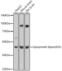 ABclonal Technology&nbsp;Lipoprotein lipase (LPL) Rabbit pAb