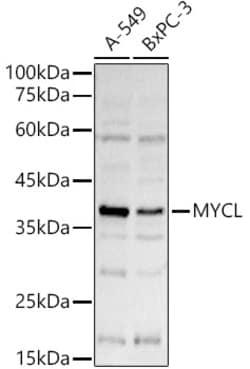 ABclonal Technology&nbsp;L-Myc Rabbit pAb