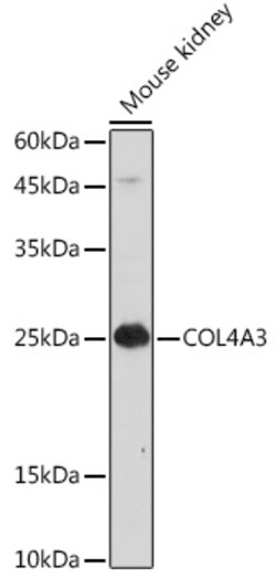 ABclonal Technology&nbsp;COL4A3 Rabbit pAb