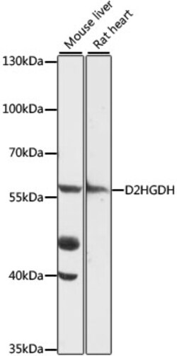 ABclonal Technology&nbsp;D2HGDH Rabbit pAb