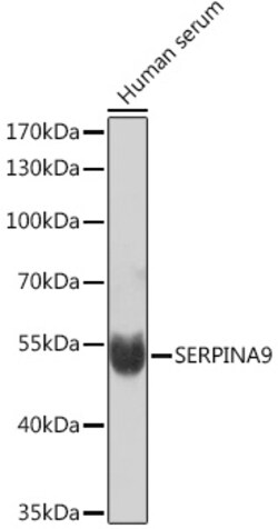 ABclonal Technology&nbsp;SERPINA9 Rabbit pAb