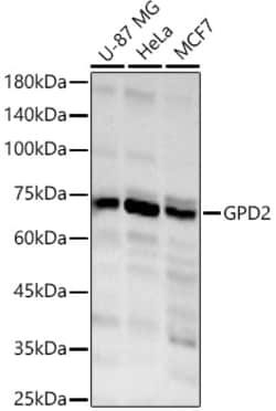 ABclonal Technology&nbsp;GPD2 Rabbit pAb