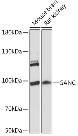 ABclonal Technology&nbsp;GANC Rabbit pAb