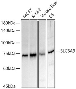 ABclonal Technology&nbsp;SLC6A9 Rabbit pAb
