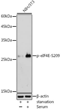 ABclonal Technology&nbsp;Phospho-eIF4E-S209 Rabbit pAb
