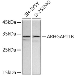 ABclonal Technology&nbsp;ARHGAP11B Rabbit pAb