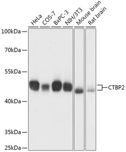ABclonal Technology&nbsp;CTBP2 Rabbit pAb