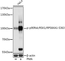 ABclonal Technology&nbsp;Phospho-p90Rsk/RSK1/RPS6KA1-S363 Rabbit pAb