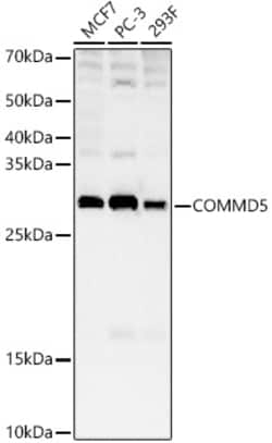 ABclonal Technology&nbsp;COMMD5 Rabbit pAb