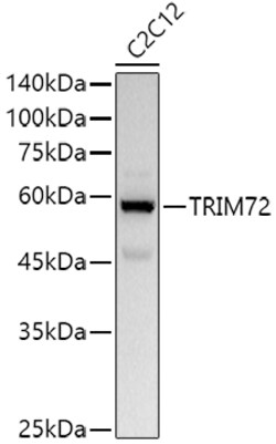 ABclonal Technology&nbsp;TRIM72 Rabbit pAb