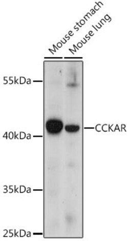 ABclonal Technology&nbsp;CCKAR Rabbit pAb