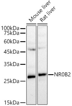 ABclonal Technology&nbsp;SHP/NR0B2 Rabbit pAb