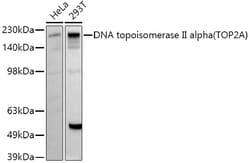ABclonal Technology&nbsp;DNA topoisomerase II alpha (TOP2A) Rabbit pAb