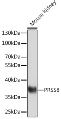 ABclonal Technology&nbsp;PRSS8 Rabbit pAb