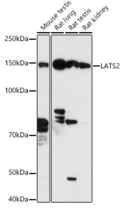 ABclonal Technology LATS2 Rabbit pAb