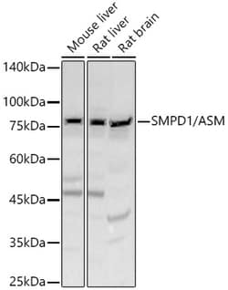 ABclonal Technology SMPD1 / ASM Rabbit pAb