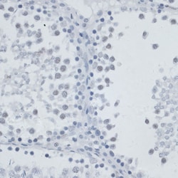 ABclonal Technology&nbsp;MSH6 Rabbit pAb